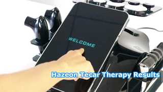 Máquina de terapia Tecar Hazeon RL-W20: dispositivo avanzado de fisioterapia y rehabilitación de 448 kHz