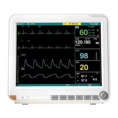 Electrocardiograma Sangre Saturación de oxígeno Temperatura corporal Monitores médicos
