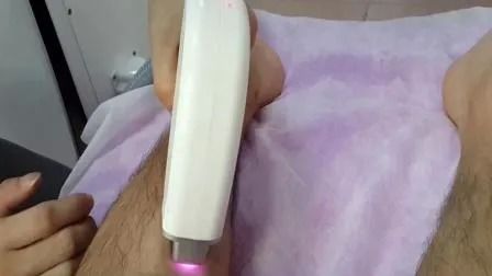 Máquina de depilación láser de diodo de 808 nm con energía de 1-50A y ancho de pulso de 1-400 ms para 6 tipos de piel